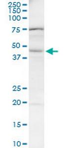 BAAT Antibody in Western Blot (WB)