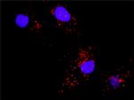 BAD Antibody in Proximity Ligation Assay (PLA) (PLA)