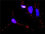 BAD Antibody in Proximity Ligation Assay (PLA) (PLA)