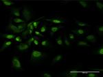 BAG1 Antibody in Immunocytochemistry (ICC/IF)