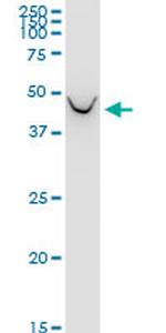 BCAT1 Antibody in Western Blot (WB)