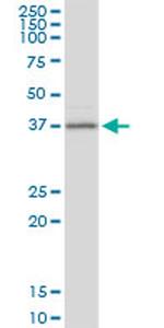 BCAT2 Antibody in Western Blot (WB)