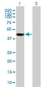 BCAT2 Antibody in Western Blot (WB)