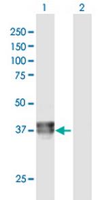 BCAT2 Antibody in Western Blot (WB)