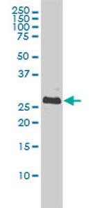 BCL2L1 Antibody in Western Blot (WB)