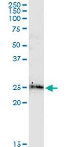 BCL2L2 Antibody in Western Blot (WB)