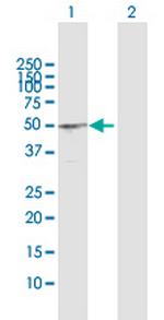 BCL3 Antibody in Western Blot (WB)