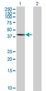 BCS1L Antibody in Western Blot (WB)