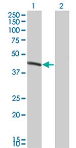 BCS1L Antibody in Western Blot (WB)