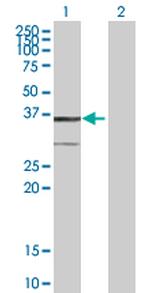 BDH1 Antibody in Western Blot (WB)