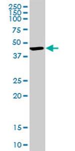 BDH1 Antibody in Western Blot (WB)