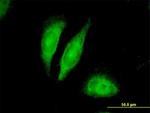 BDNF Antibody in Immunocytochemistry (ICC/IF)