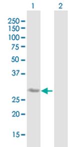 BDNF Antibody in Western Blot (WB)