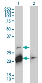 BID Antibody in Western Blot (WB)