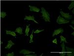 BID Antibody in Immunocytochemistry (ICC/IF)