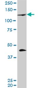 PRDM1 Antibody in Western Blot (WB)