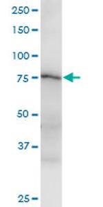 PRDM1 Antibody in Western Blot (WB)