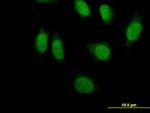 PRDM1 Antibody in Immunocytochemistry (ICC/IF)