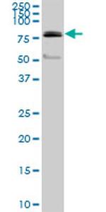 PRDM1 Antibody in Western Blot (WB)