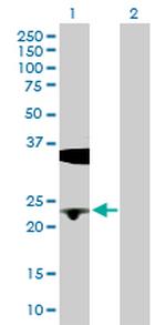 BLVRB Antibody in Western Blot (WB)