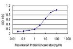 BMPR1B Antibody in ELISA (ELISA)