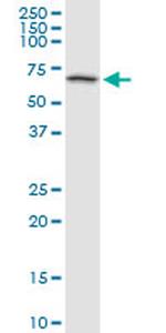 BMPR1B Antibody in Western Blot (WB)