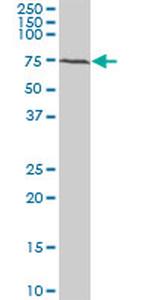 BMPR1B Antibody in Western Blot (WB)