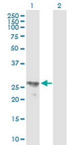 BPHL Antibody in Western Blot (WB)