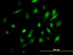 BST2 Antibody in Immunocytochemistry (ICC/IF)