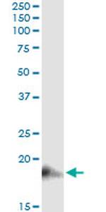 BST2 Antibody in Immunoprecipitation (IP)