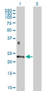 BTC Antibody in Western Blot (WB)