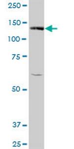 BUB1 Antibody in Western Blot (WB)