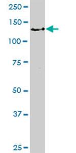 BUB1 Antibody in Western Blot (WB)