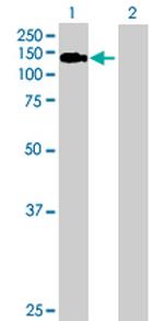 BUB1 Antibody in Western Blot (WB)