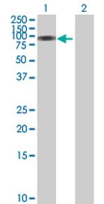 SERPING1 Antibody in Western Blot (WB)