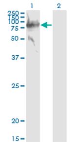 SERPING1 Antibody in Western Blot (WB)