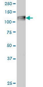 C3 Antibody in Western Blot (WB)