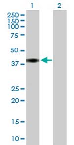 C4BPB Antibody in Western Blot (WB)