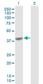 C4BPB Antibody in Western Blot (WB)