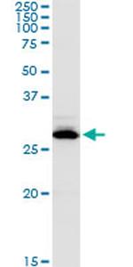 CA1 Antibody in Western Blot (WB)