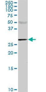 CA1 Antibody in Western Blot (WB)