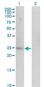 CA1 Antibody in Western Blot (WB)