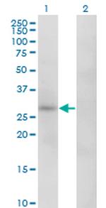 CA1 Antibody in Western Blot (WB)