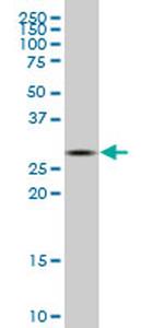 CA1 Antibody in Western Blot (WB)