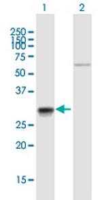 CA7 Antibody in Western Blot (WB)