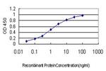 CACNB2 Antibody in ELISA (ELISA)