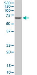 CACNB2 Antibody in Western Blot (WB)