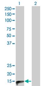 CALCA Antibody in Western Blot (WB)