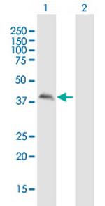 CALU Antibody in Western Blot (WB)