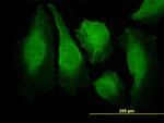 CAMK2B Antibody in Immunocytochemistry (ICC/IF)